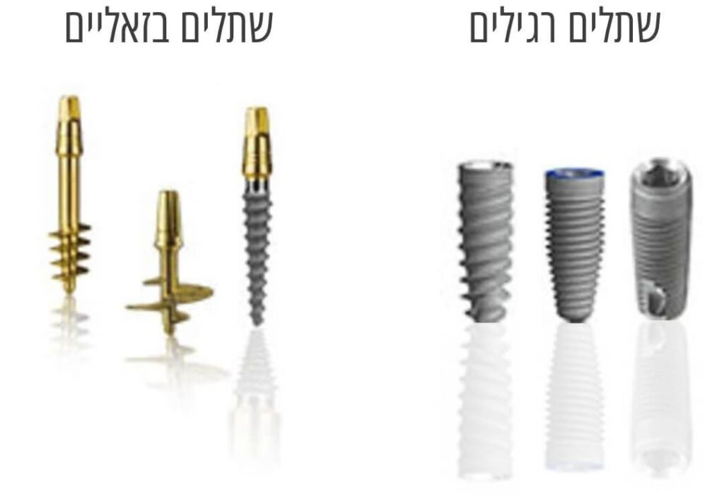 שתלים בזאליים 🦷| השתלות שיניים במרכז רפואי GARA CLINIC