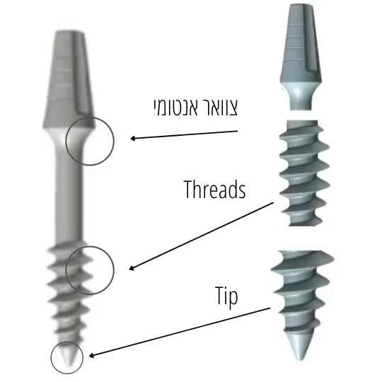 סימני דחיית שתל שיניים 🦷 | השתלות שיניים GARA CLINIC