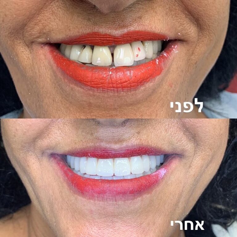 smile-4.jpg