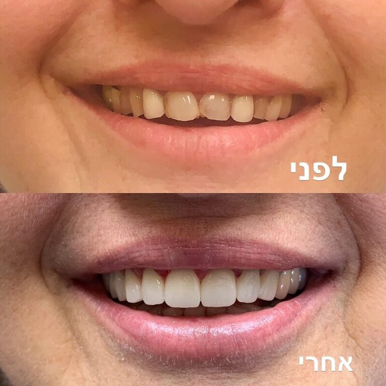 smile-8.jpg