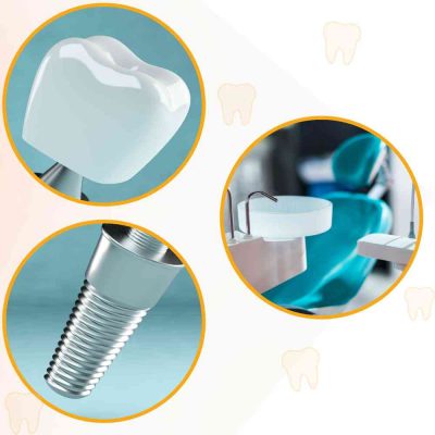 גורמים המשפיעים על השתלת שיניים