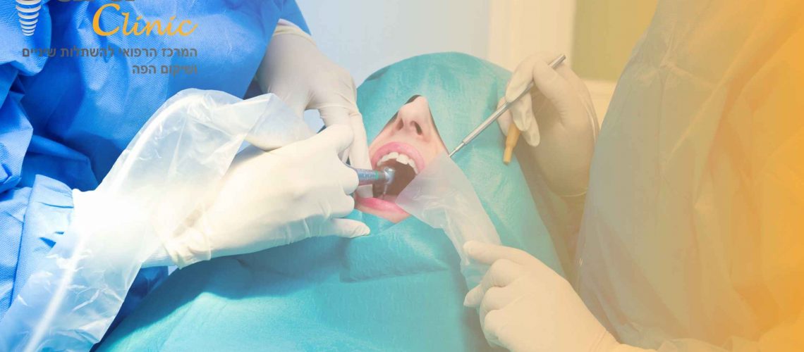 השתלת שיניים ללא הרמת סינוס או השתלת עצם