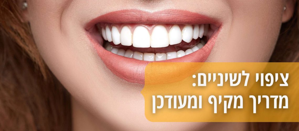 מדריך ציפויים חרסינה לשיניים