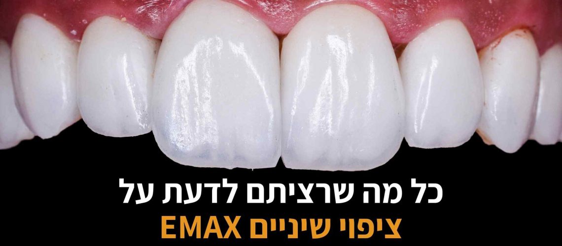 ציפויי שיניים איימקס EMAX